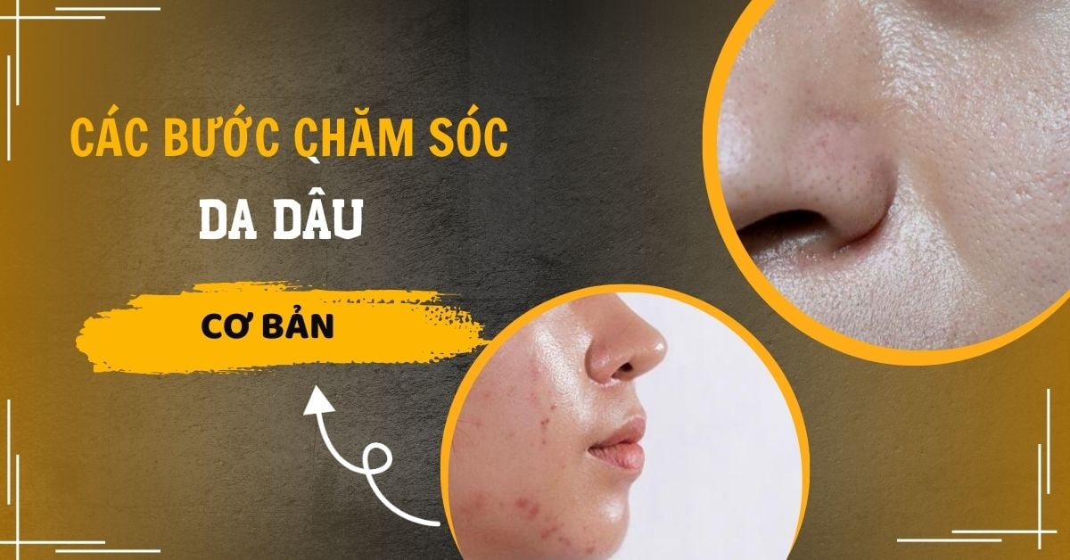 Các Bước Chăm Sóc Da Dầu Cơ Bản Cho Nam Chuẩn Khoa Học