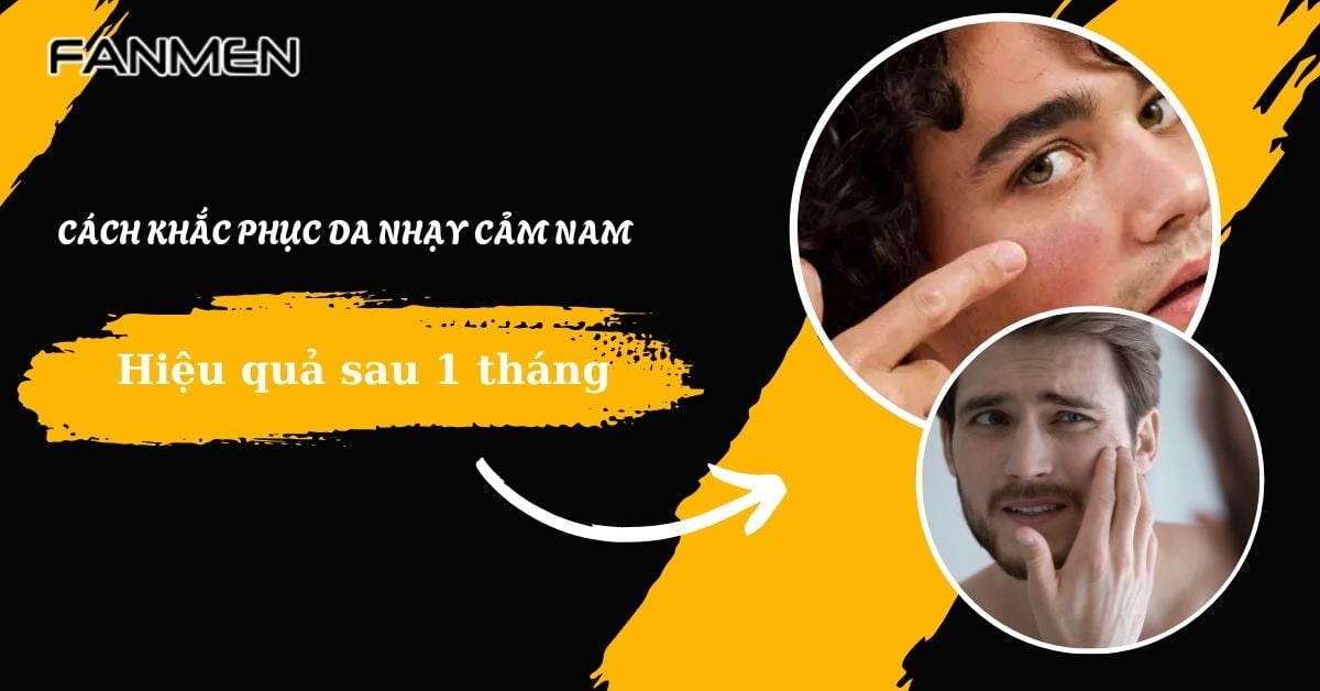 Cách Khắc Phục Da Nhạy Cảm Nam Hiệu Quả Sau #1 Tháng Áp Dụng
