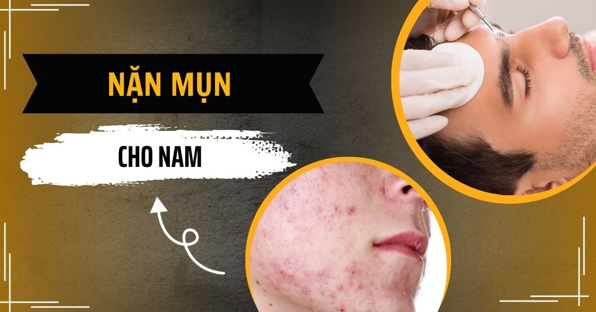 Tip Nặn Mụn Cho Nam Không Để Lại Thâm Và Sẹo Rỗ Hiệu Quả