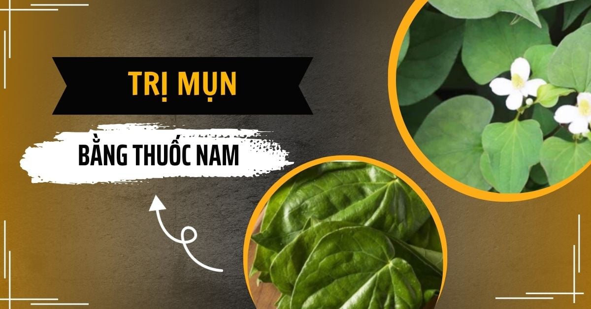 Cách Trị Mụn Bằng Thuốc Nam Mang Lại Hiệu Quả 90% Tại Nhà