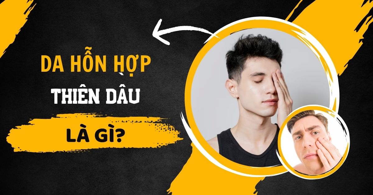 Da Hỗn Hợp Thiên Dầu Là Gì? Liệu Trình Chăm Sóc Đúng – Chuẩn