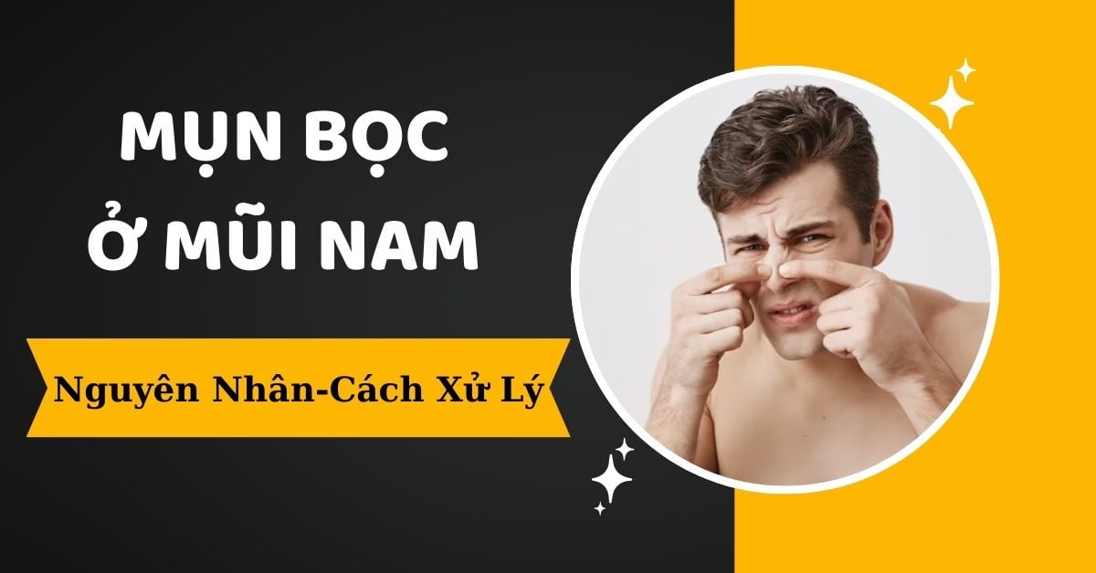 Cách Xử Lý Mụn Bọc Ở Mũi Nam Hiệu Quả 7 Ngày Áp Dụng