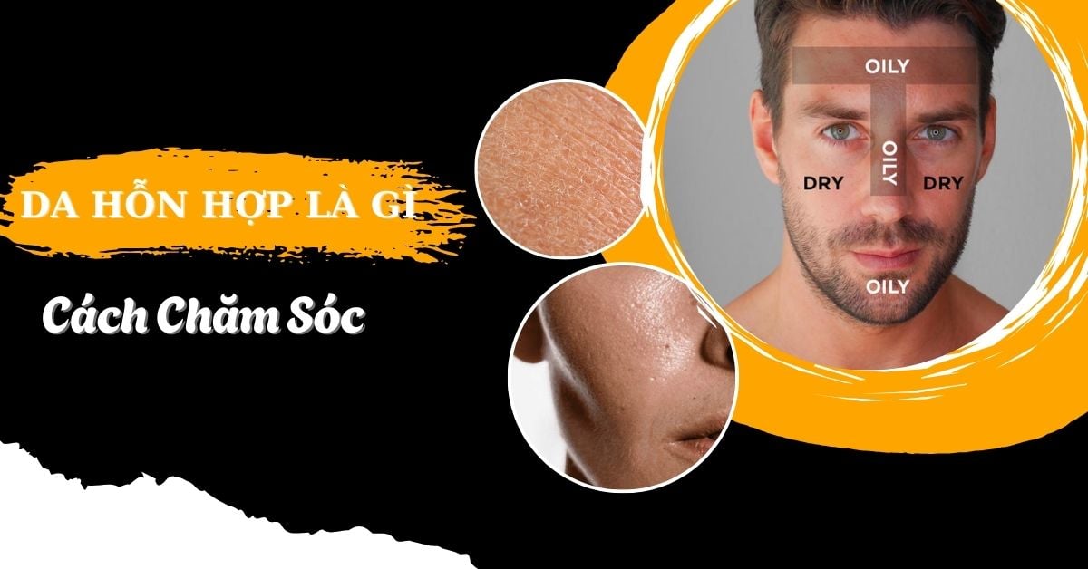 Da Hỗn Hợp Là Gì? Cách Chăm Sóc Da Hỗn Hợp Nam Từ Bác Sĩ