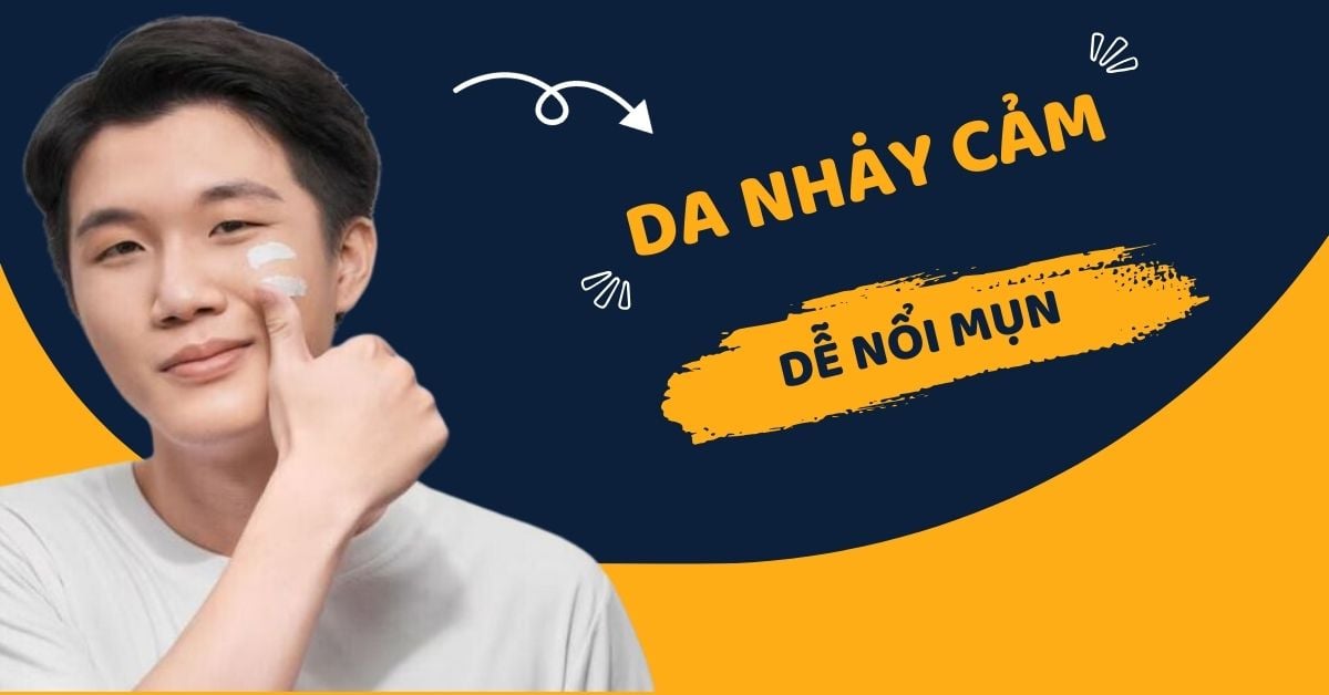 Chăm Sóc Cho Da Nhạy Cảm Dễ Nổi Mụn Nam Hiệu Quả Sau 5 Ngày