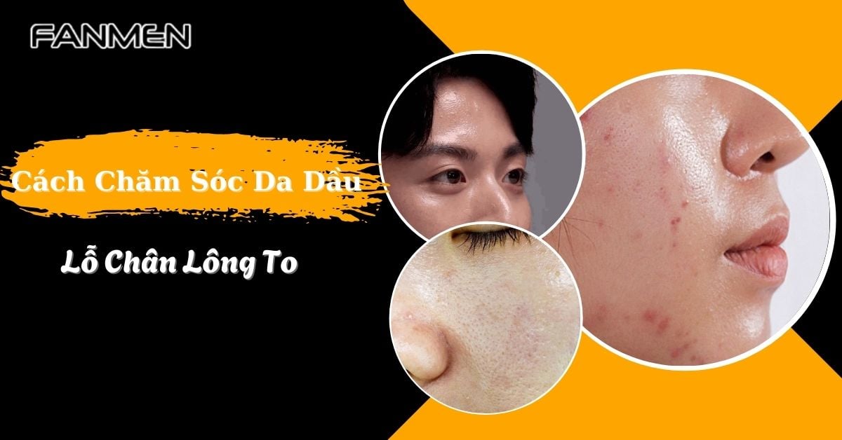 Cách Chăm Sóc Da Dầu Lỗ Chân Lông To: 7+ Bước Chuẩn Da Liễu