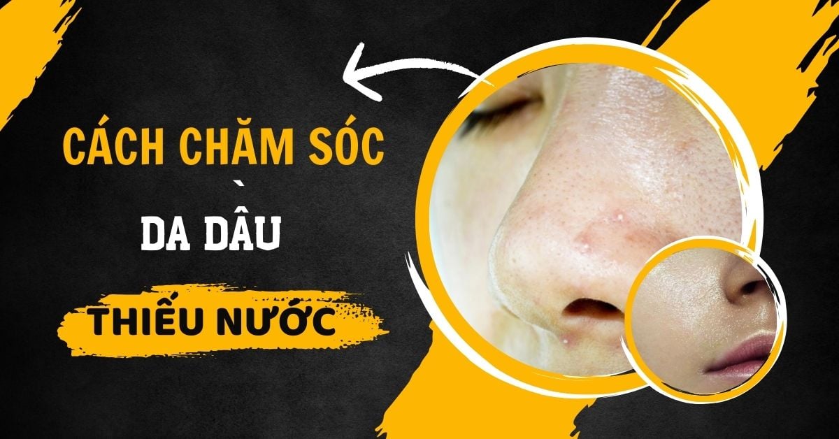 Cách Chăm Sóc Da Dầu Thiếu Nước Cho Nam Chuẩn Khoa Học