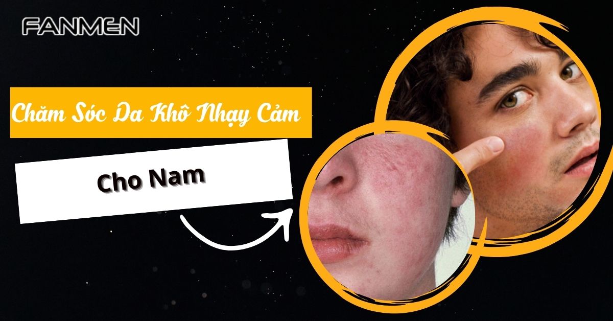 Chăm Sóc Da Khô Nhạy Cảm Cho Nam Từ Bác Sĩ Da Liễu