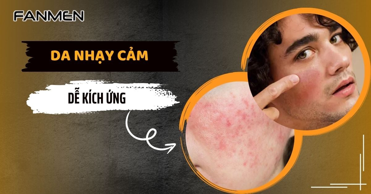 Da Nhạy Cảm Dễ Kích Ứng Là Gì? 5 Bước Hiệu Quả Cho Nam
