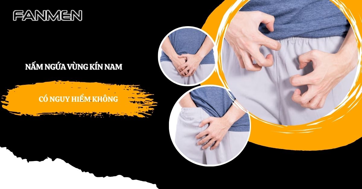 Nấm Ngứa Vùng Kín Nam Có Nguy Hiểm Không? Cách Xử Lý