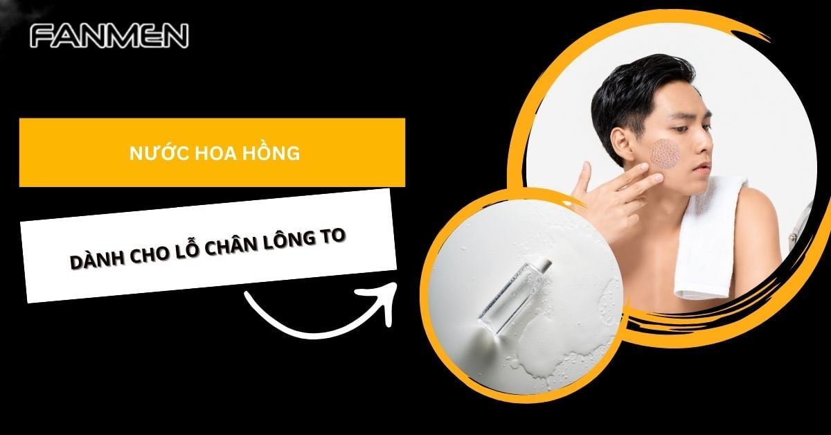 Top 7 Nước Hoa Hồng Dành Cho Da Dầu Lỗ Chân Lông To Tốt Nhất
