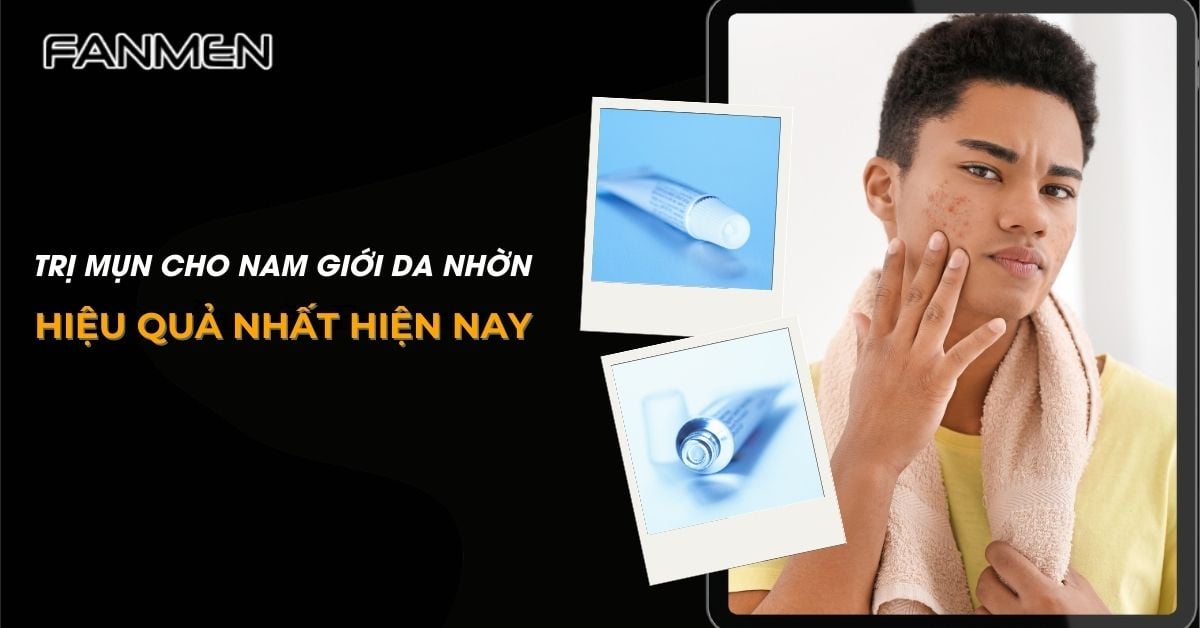 4 Cách Trị Mụn Cho Nam Giới Da Nhờn Hiệu Quả Nhất Hiện Nay