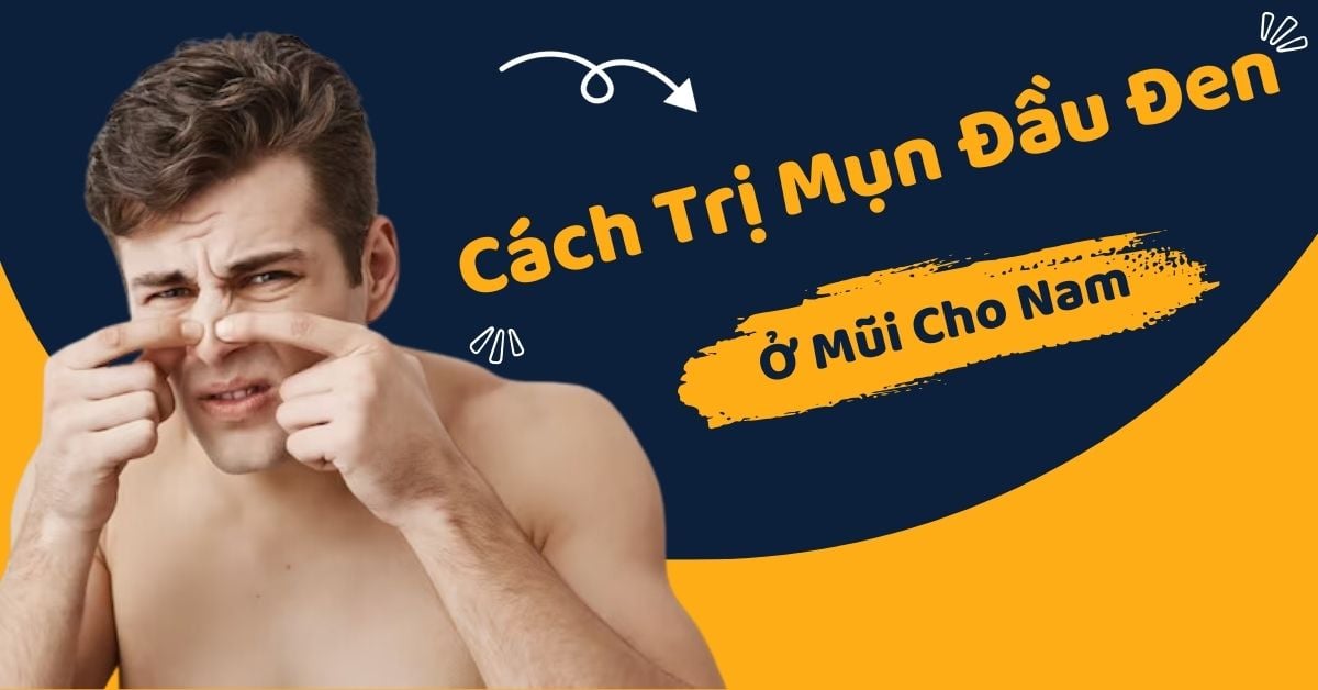 Cách Trị Mụn Đầu Đen Ở Mũi Cho Nam Hiệu Quả Chỉ Sau 7 Ngày