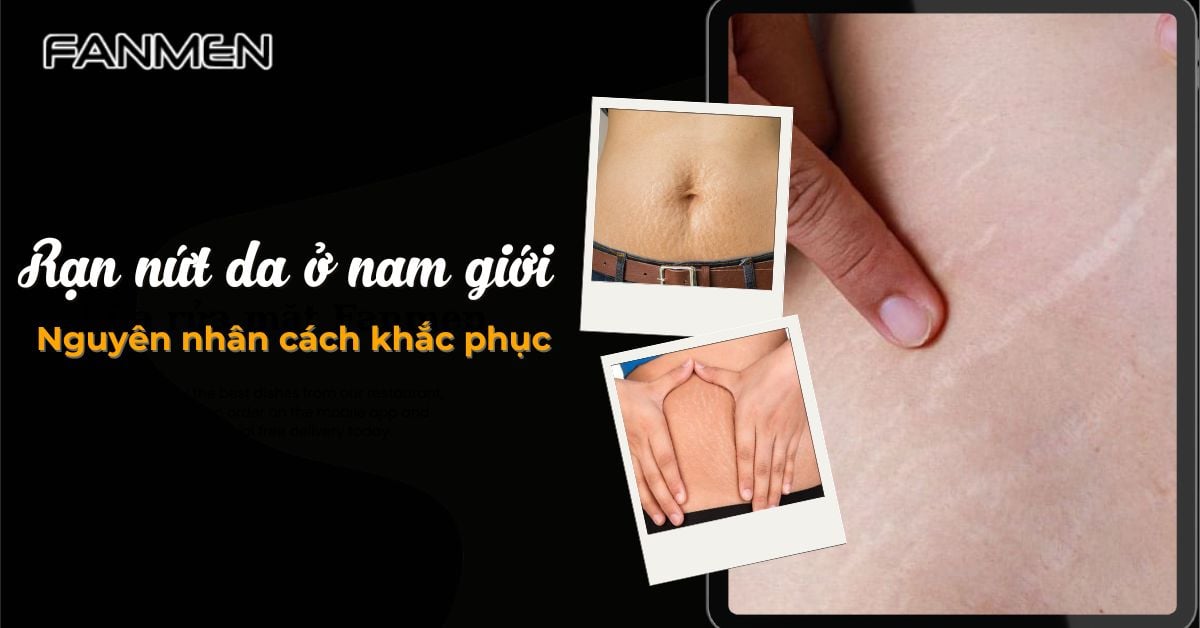 Rạn Nứt Da Ở Nam Giới: Nguyên Nhân Và Cách Khắc Phục