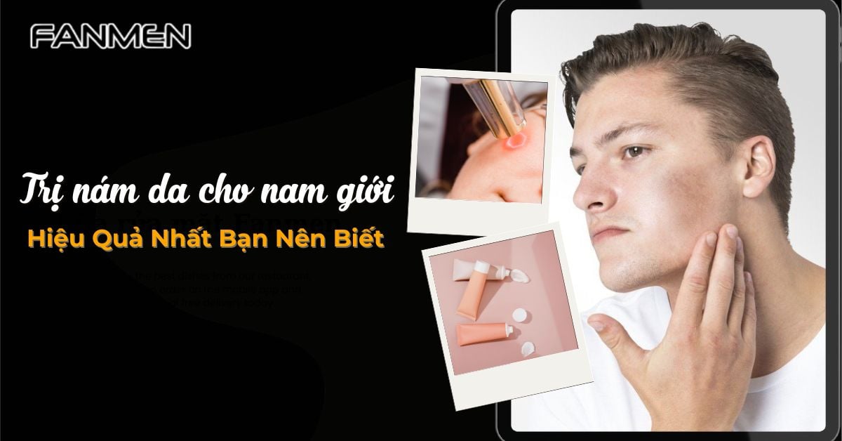 15+ Cách Trị Nám Da Cho Nam Giới Hiệu Quả Nhất Bạn Nên Biết