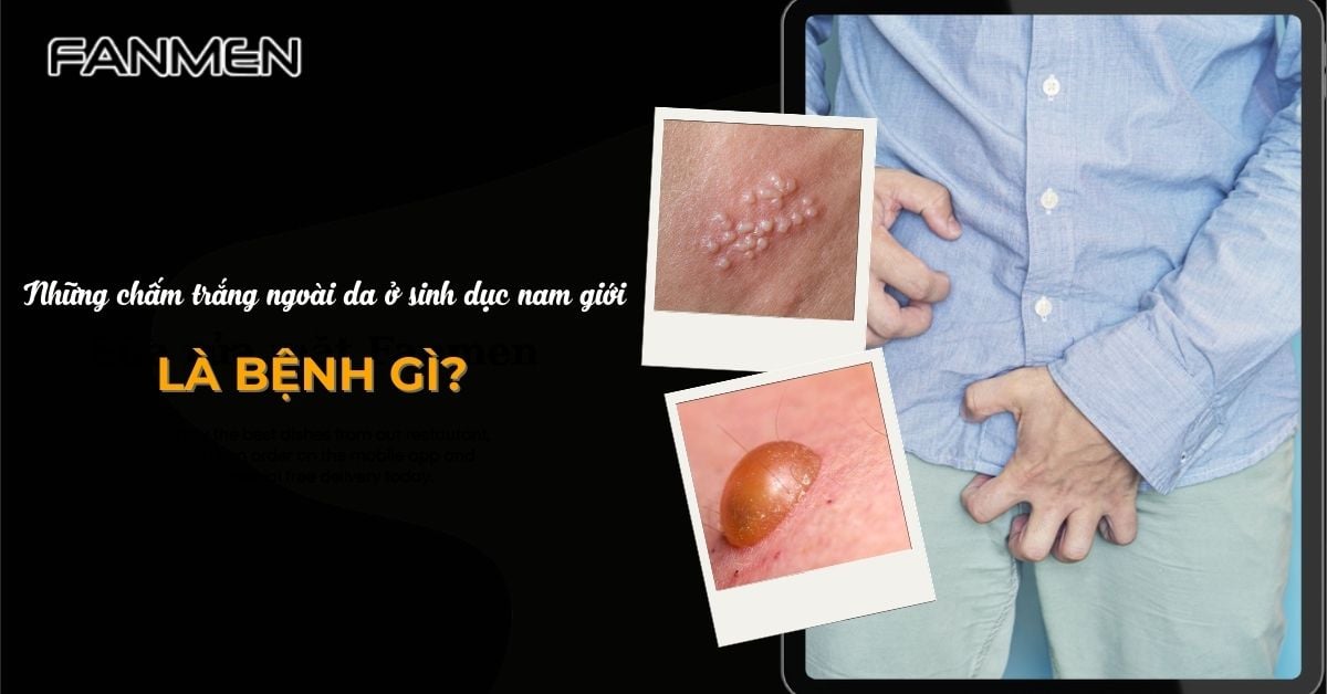 Những Chấm Trắng Ngoài Da Ở Sinh Dục Nam Giới Là Bệnh Gì?