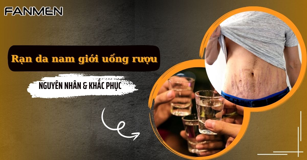 Rạn Da Nam Giới Uống Rượu: Nguyên Nhân & Khắc Phục
