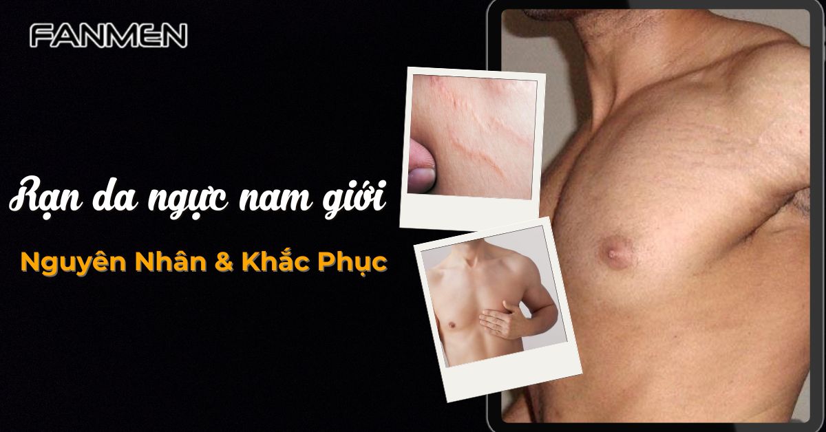 Rạn Da Ngực Nam Giới: Nguyên Nhân & Cách Khắc Phục