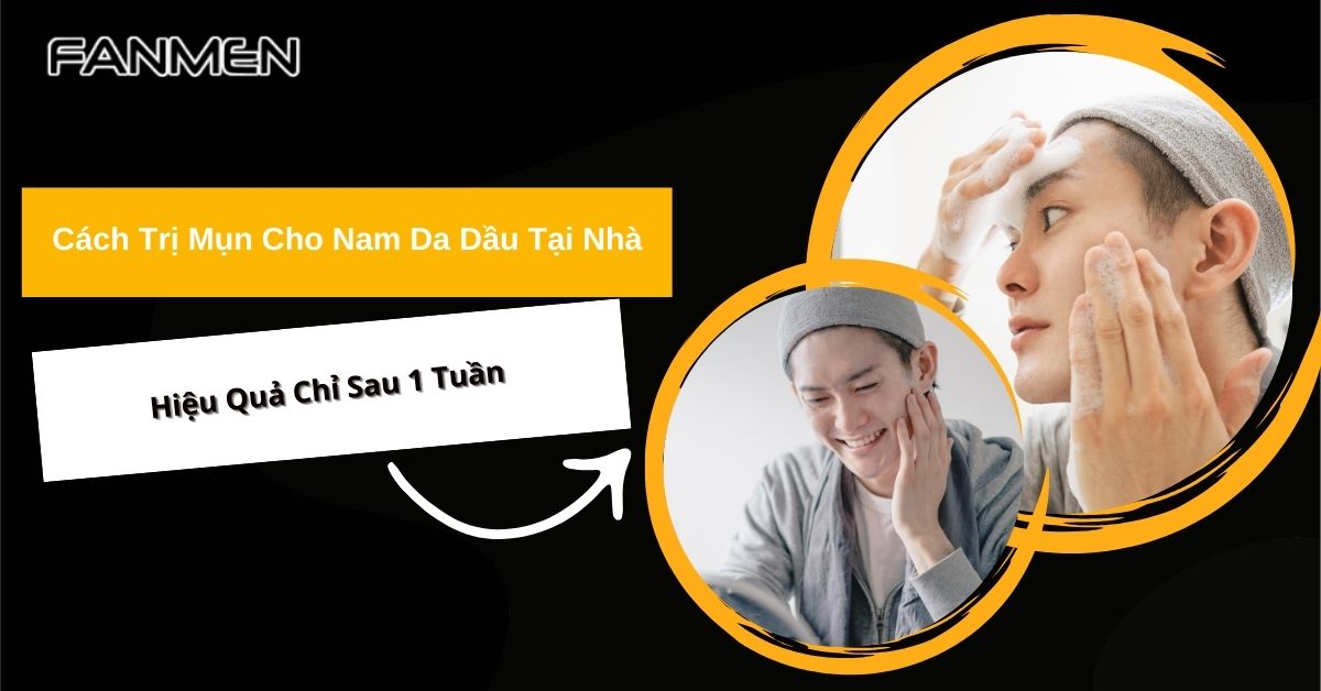 Cách Trị Mụn Cho Nam Da Dầu Tại Nhà Hiệu Quả Chỉ Sau 1 Tuần