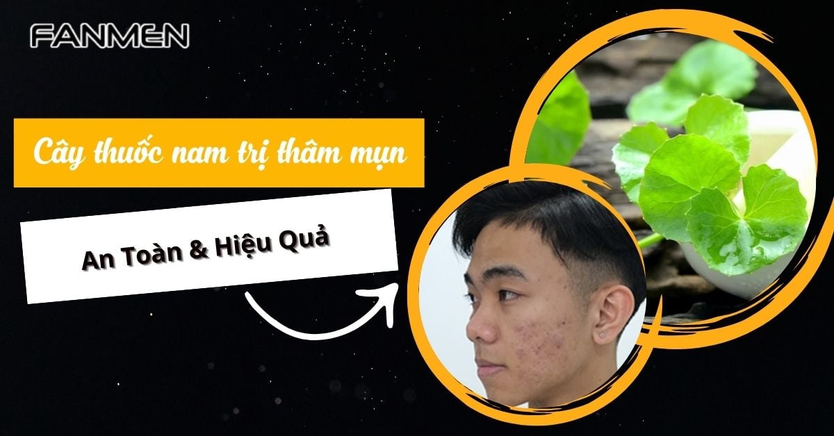 5 Cây Thuốc Nam Trị Thâm Mụn: An Toàn & Hiệu Quả 2025