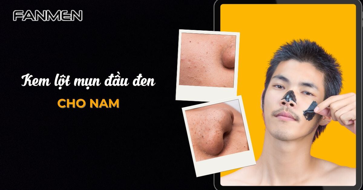 5 Kem Lột Mụn Đầu Đen Cho Nam Sạch Mụn Chỉ Sau 1 Lần Lột