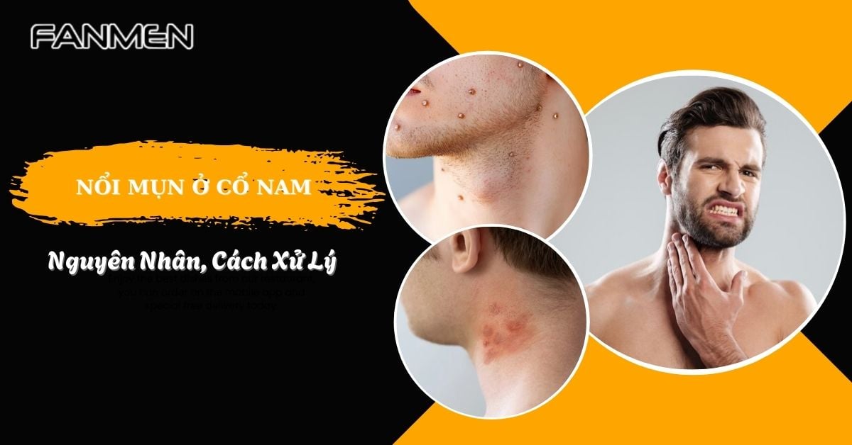 Nổi Mụn Ở Cổ Nam Có Nguy Hiểm Không? Nguyên Nhân, Cách Xử Lý