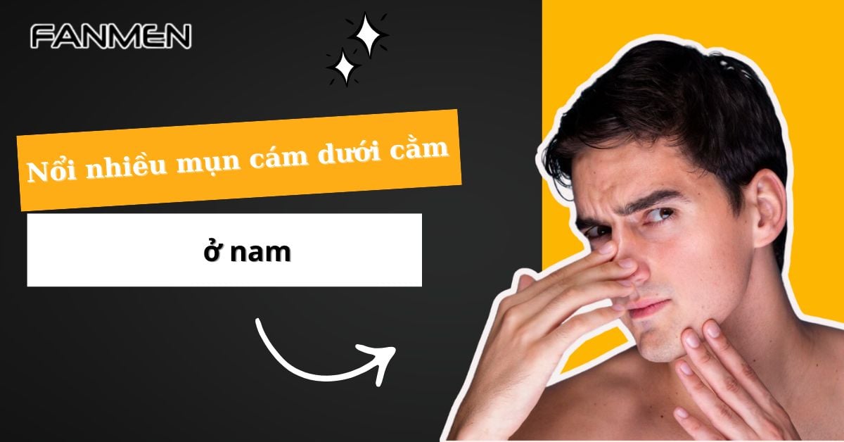 Nổi Nhiều Mụn Cám Dưới Cằm Ở Nam: Nguyên Nhân & Khắc Phục