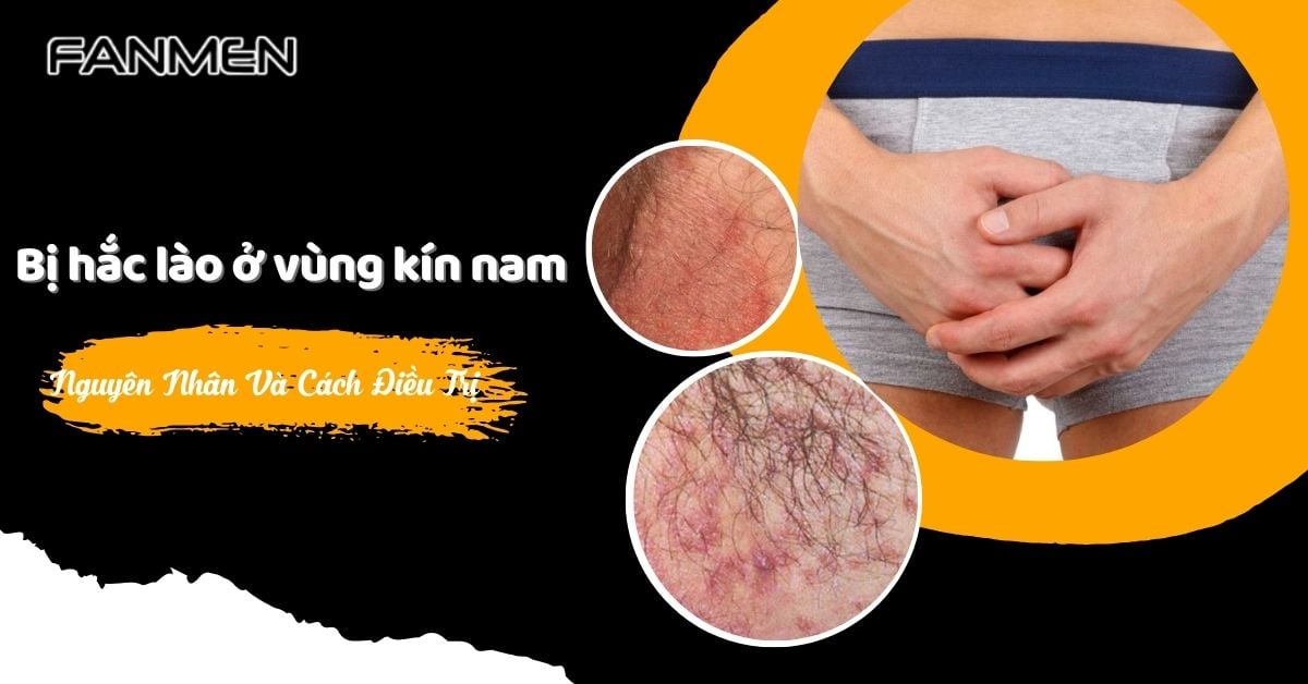 Bị Hắc Lào Ở Vùng Kín Nam: Nguyên Nhân Và Cách Điều Trị