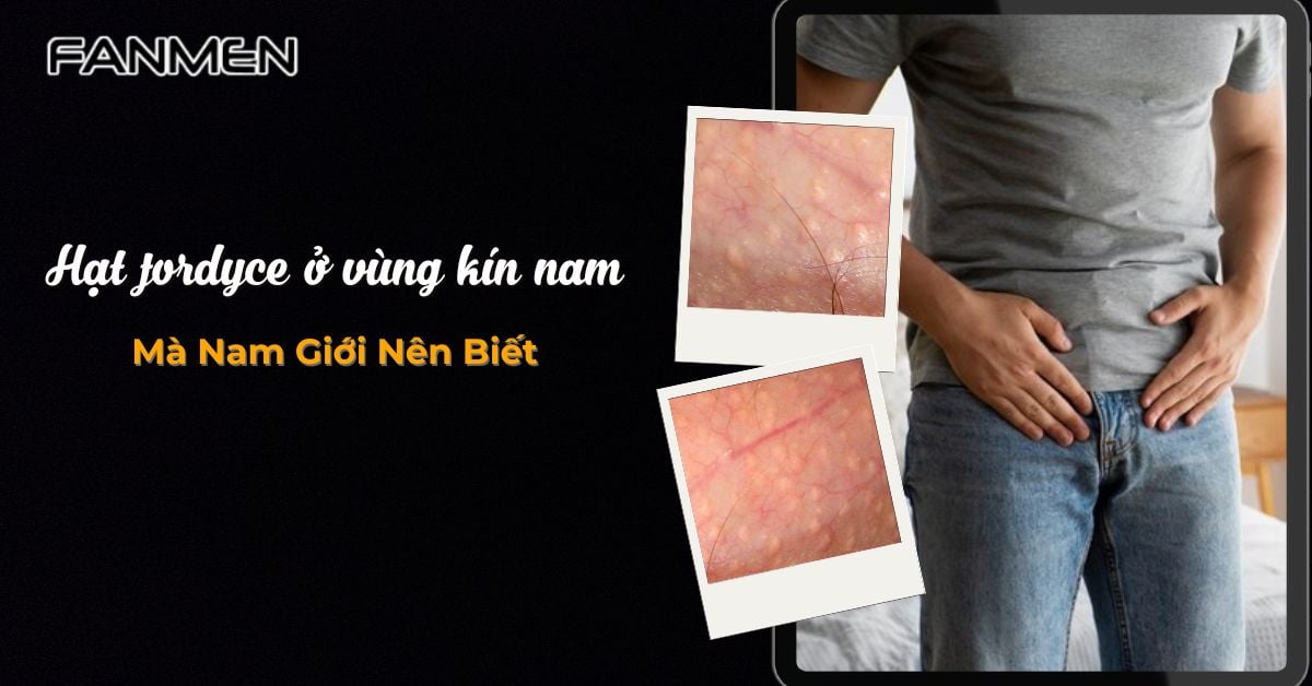 Sự Thật Hạt Fordyce Ở Vùng Kín Nam: 100% Nam Giới Nên Biết