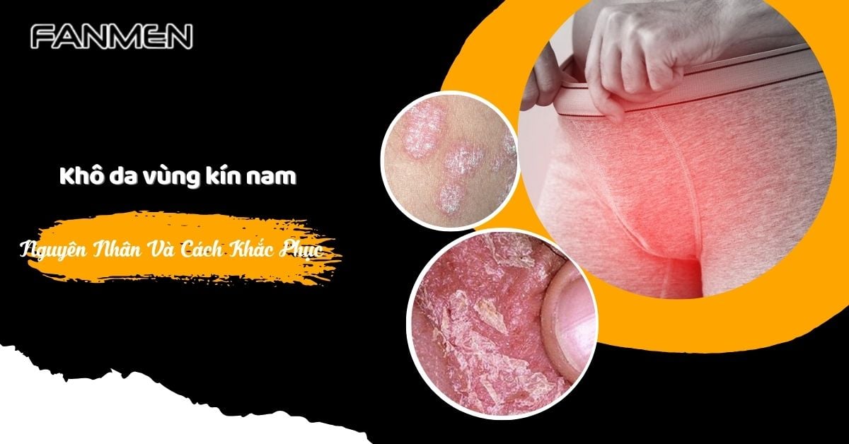 Khô Da Vùng Kín Nam: Nguyên Nhân Và Cách Khắc Phục