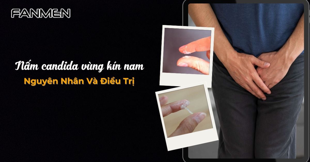 Nguyên Nhân Gây Ra Nấm Candida Vùng Kín Nam Và Cách Điều Trị