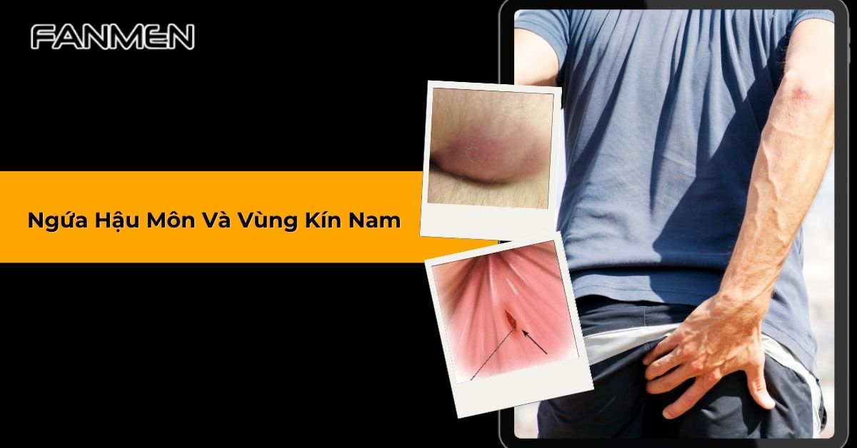 Ngứa Hậu Môn Và Vùng Kín Nam: Nguyên Nhân Và Cách Khắc Phục