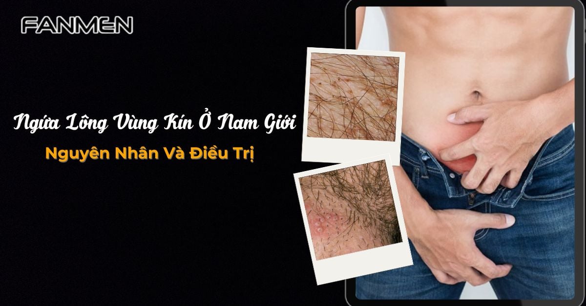 Nguyên Nhân Ngứa Lông Vùng Kín Ở Nam Giới Và Cách Điều Trị