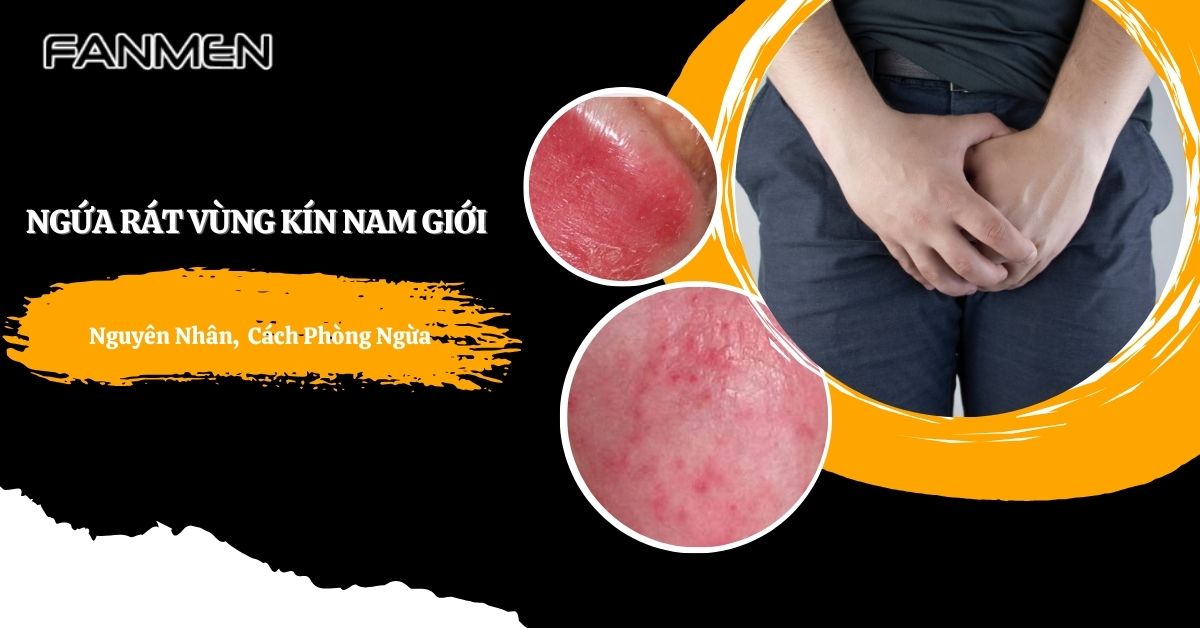 Ngứa Rát Vùng Kín Nam Giới: Nguyên Nhân Và Cách Phòng Ngừa