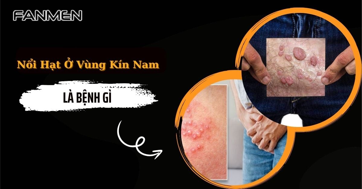 Nổi Hạt Ở Vùng Kín Nam Là Dấu Hiệu Bệnh Gì? Nguy Hiểm Không