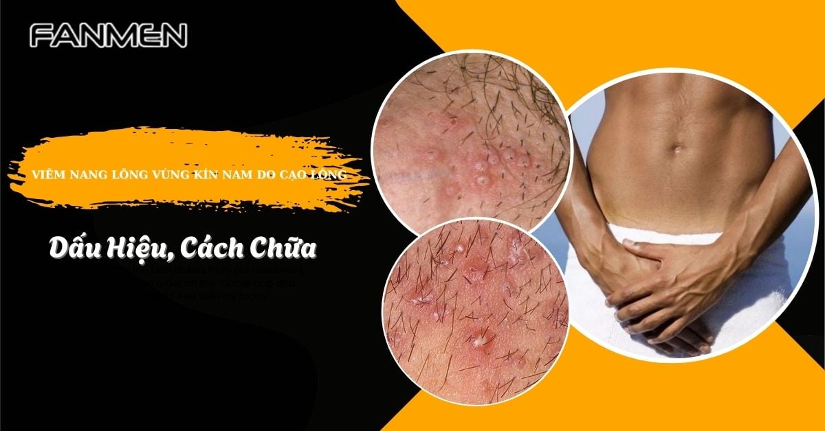 Viêm Nang Lông Vùng Kín Nam Do Cạo Lông: Dấu Hiệu, Cách Chữa