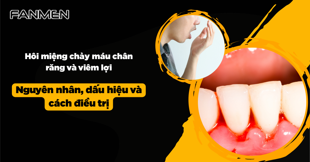 Hôi Miệng Chảy Máu Chân Răng Viêm Lợi: Nguyên Nhân, Cách Trị