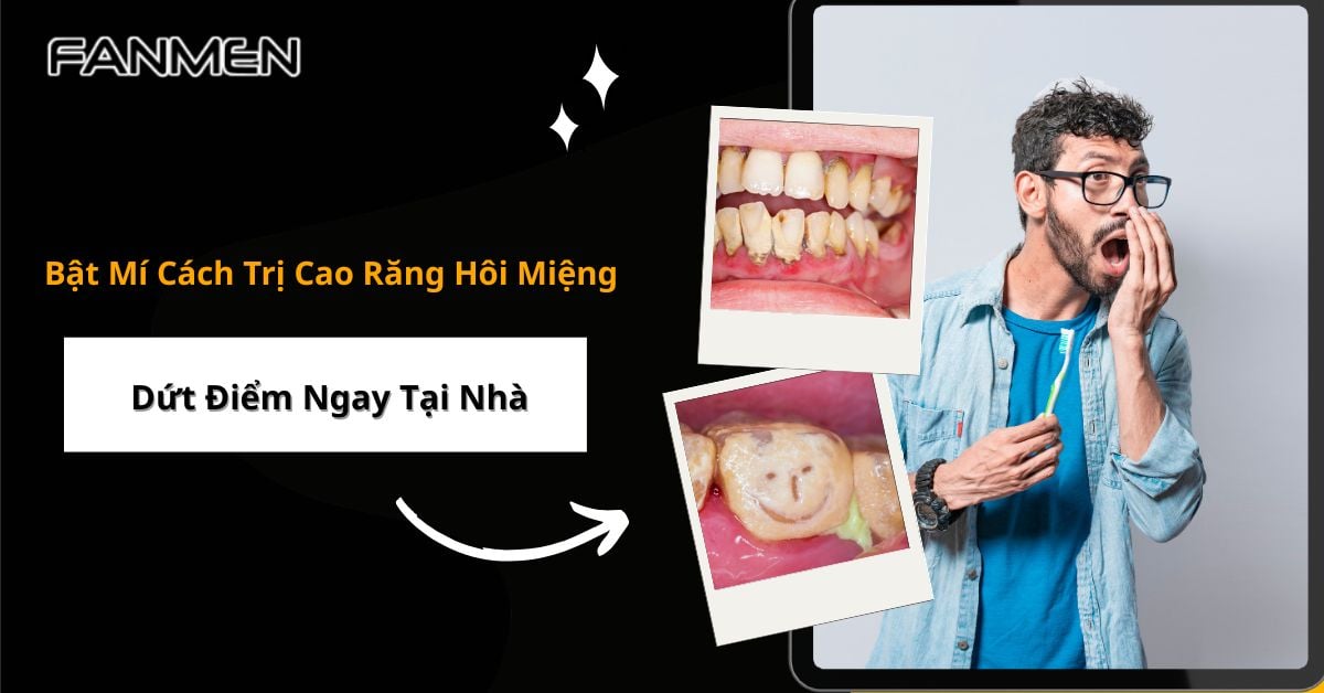 Bật Mí Cách Trị Cao Răng Hôi Miệng Dứt Điểm Ngay Tại Nhà
