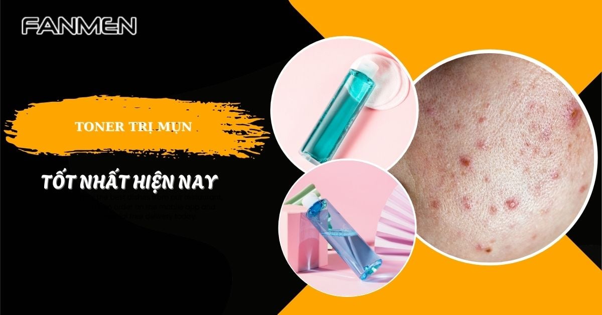 Review 7 Toner Trị Mụn Hiệu Quả, Chuyên Gia Khuyên Dùng