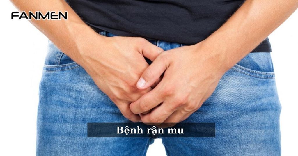 Bệnh rận mu