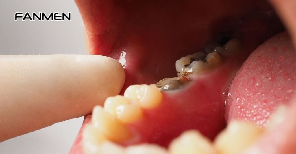 Do mắc bệnh về răng miệng