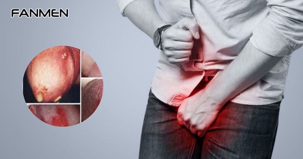 Bệnh lý xã hội