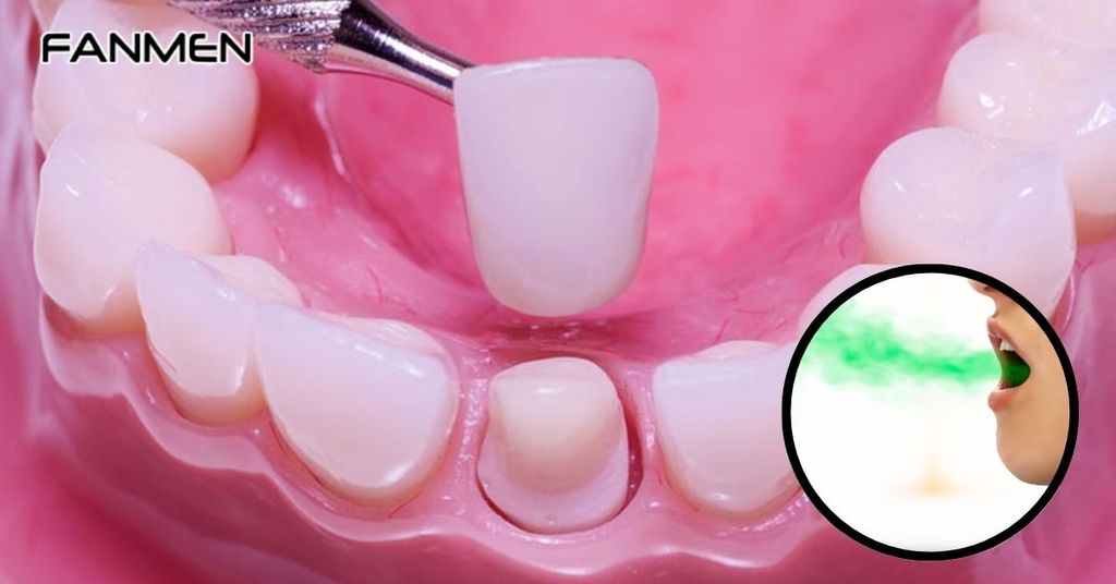 Bọc răng sứ có bị hôi miệng không?