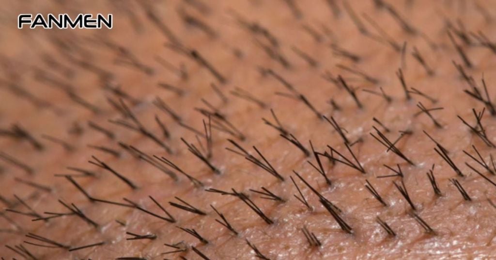 Cấy lông mu tự thân