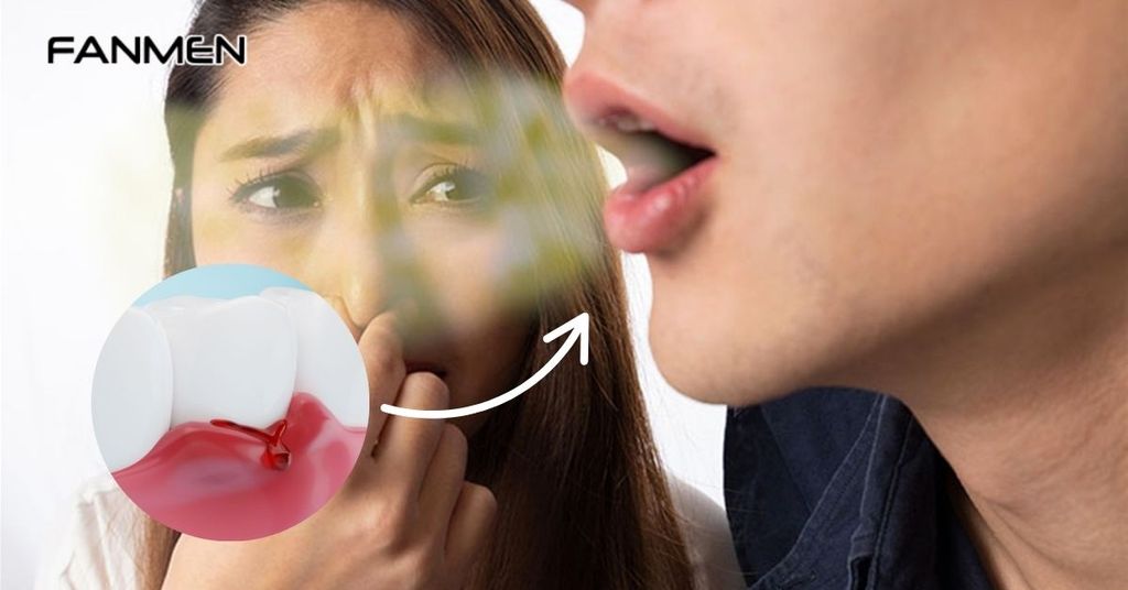 Thế Nào Là Tình Trạng Chảy Máu Chân Răng Dẫn Đến Hôi Miệng?
