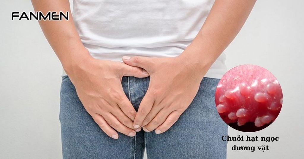 Chuỗi hạt ngọc dương vật