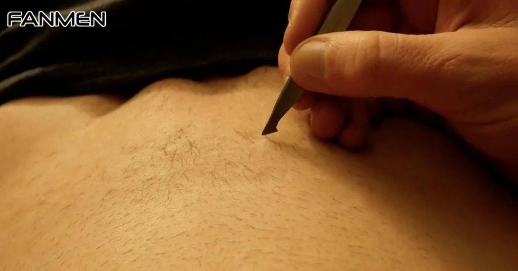 Có Nên Nhổ Lông Vùng Kín Nam Không?