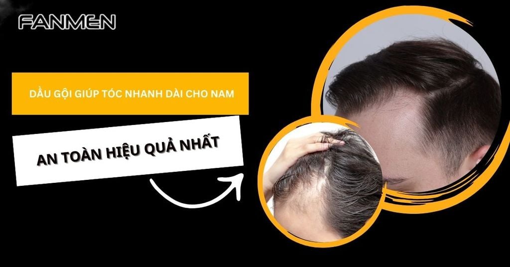 dầu gội giúp tóc nhanh dài cho nam