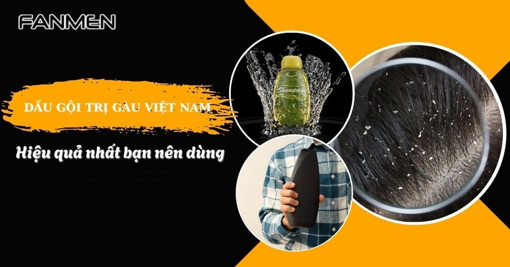 dầu gội trị gàu việt nam