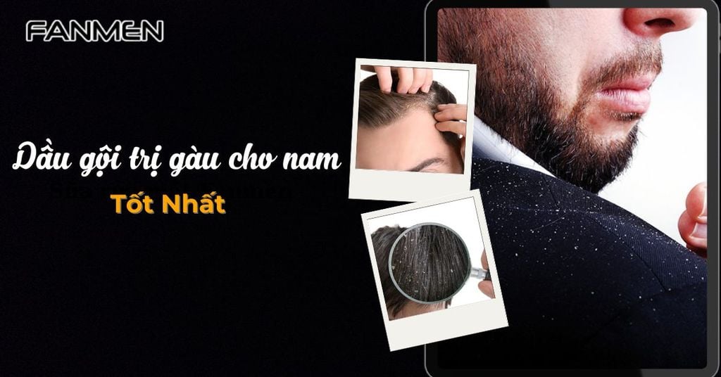 Dầu gội trị gàu cho nam