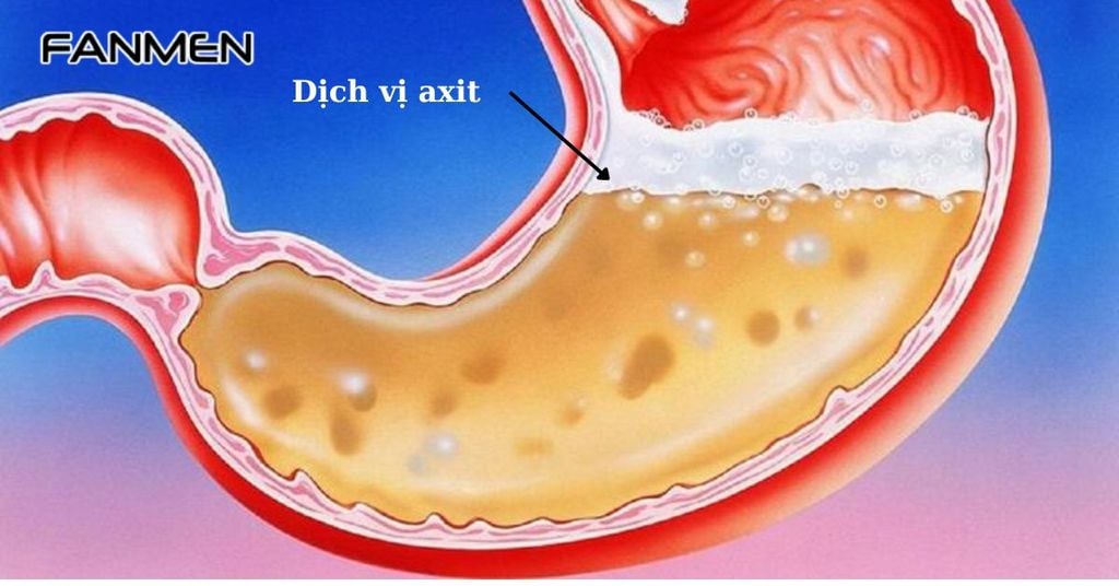 Dịch vị acid trào ngược lên miệng